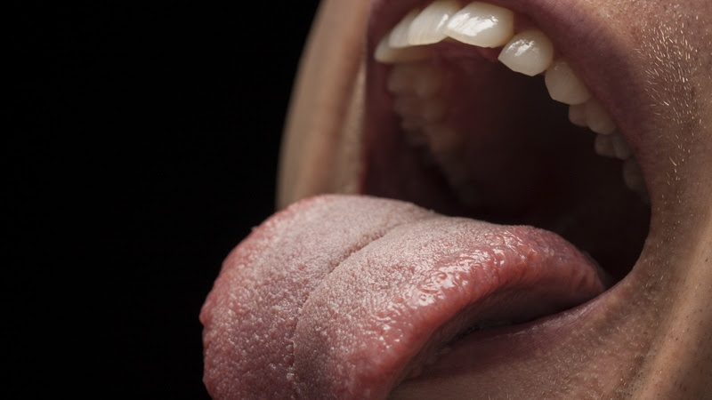 Raspar a língua diariamente combate o mau hálito e outras doenças